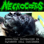 Necrocoitus - Revolting Intimacies in Squamous Cell Carcinoma