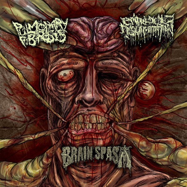 Pulmonary Fibrosis / Entrenched Ingurgitation / Brain Spasm - Split
