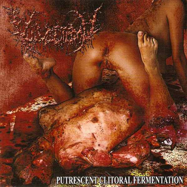 Vulvectomy - Putrescent Clitoral Fermentation